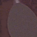 Difficile (L54) 
